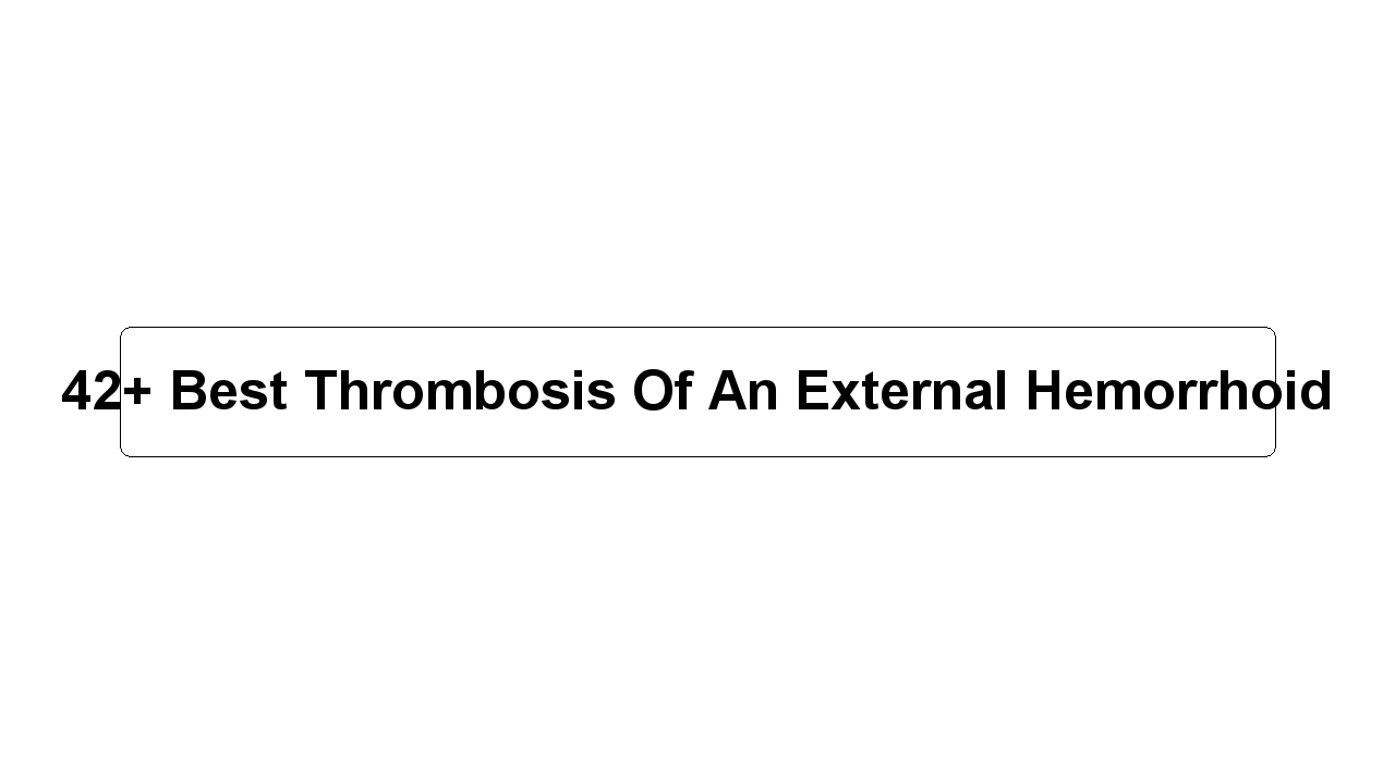 42+ Best Thrombosis Of An External Hemorrhoid