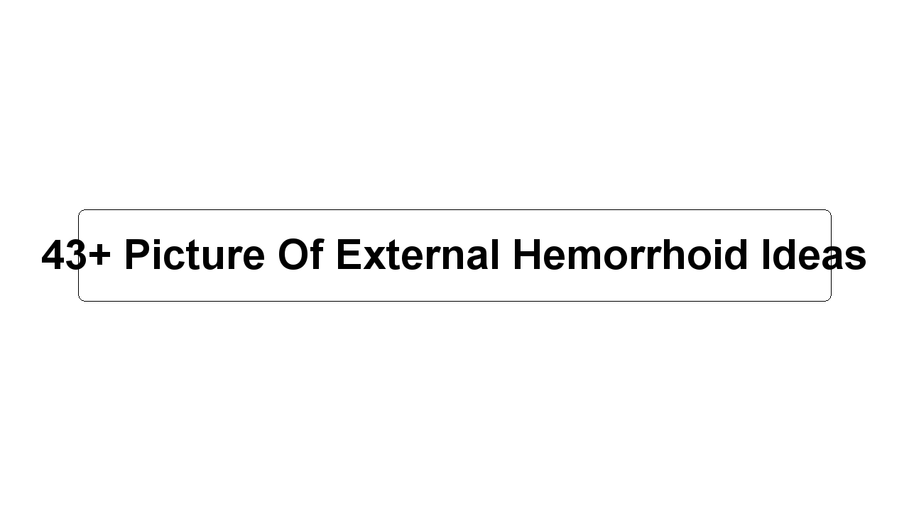 43+ Picture Of External Hemorrhoid Ideas