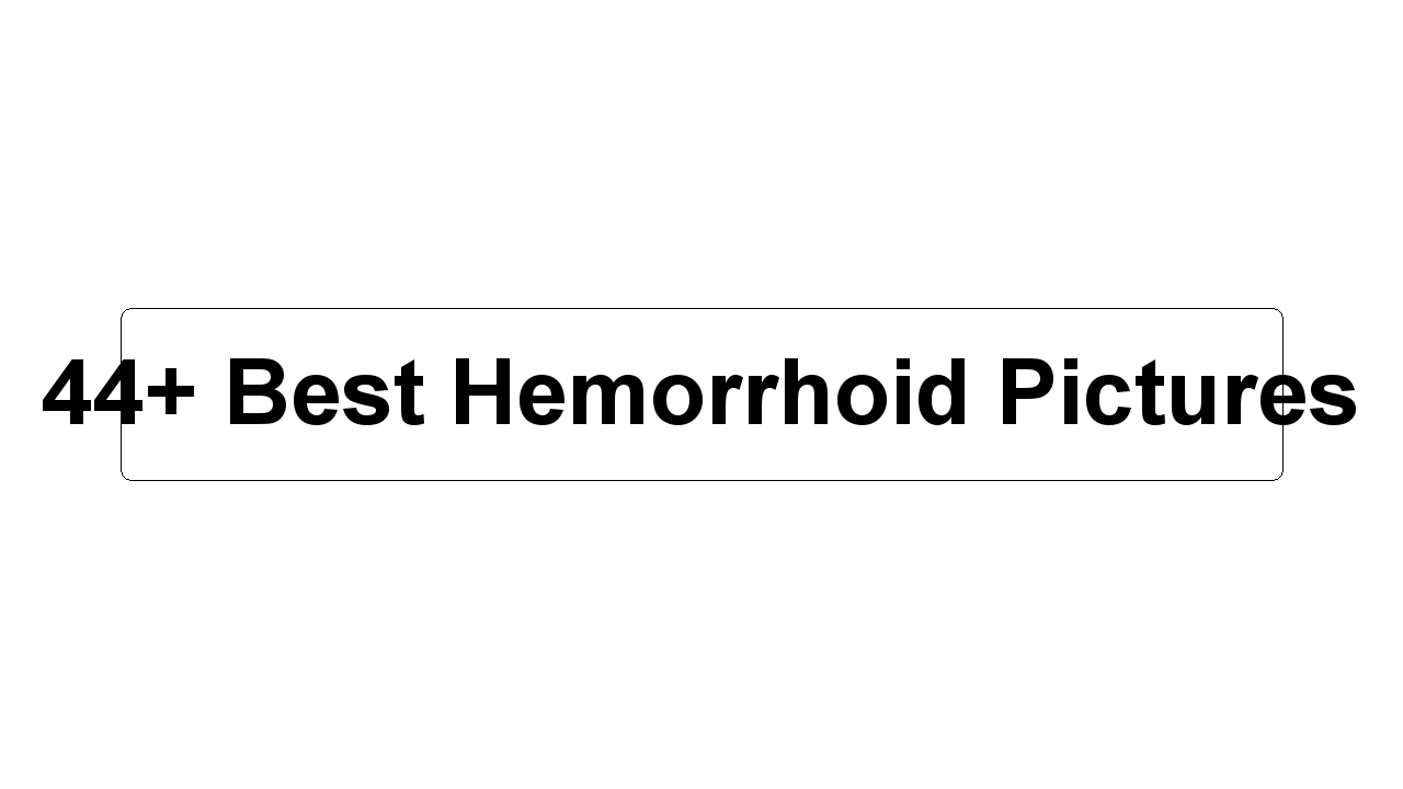 44+ Best Hemorrhoid Pictures