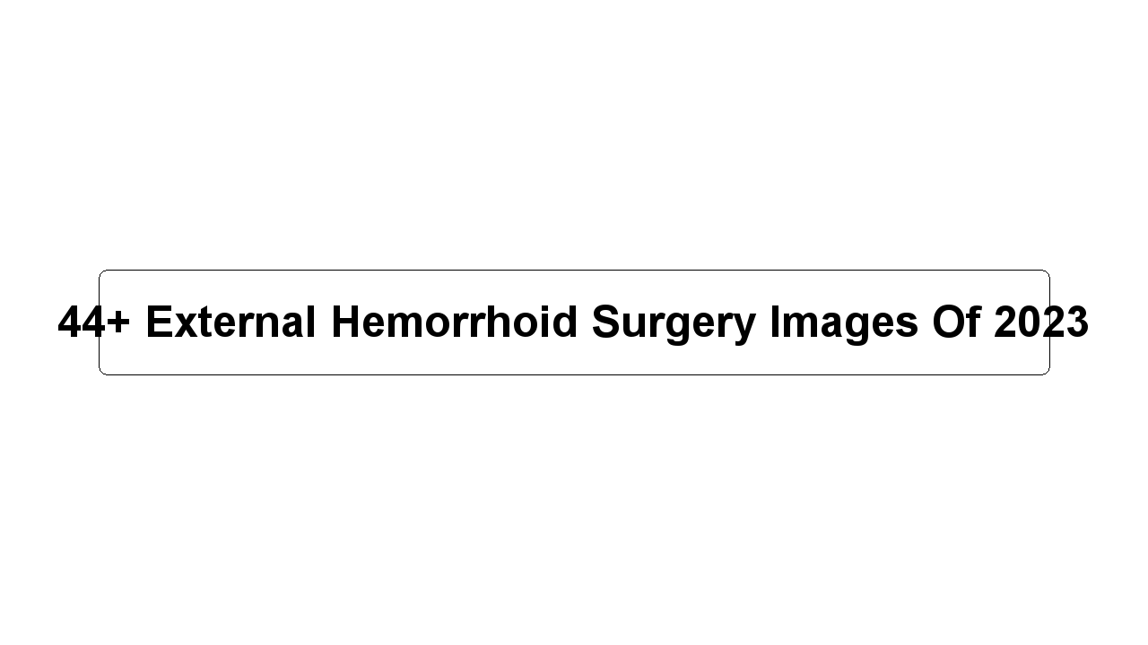 44+ External Hemorrhoid Surgery Images Of 2023