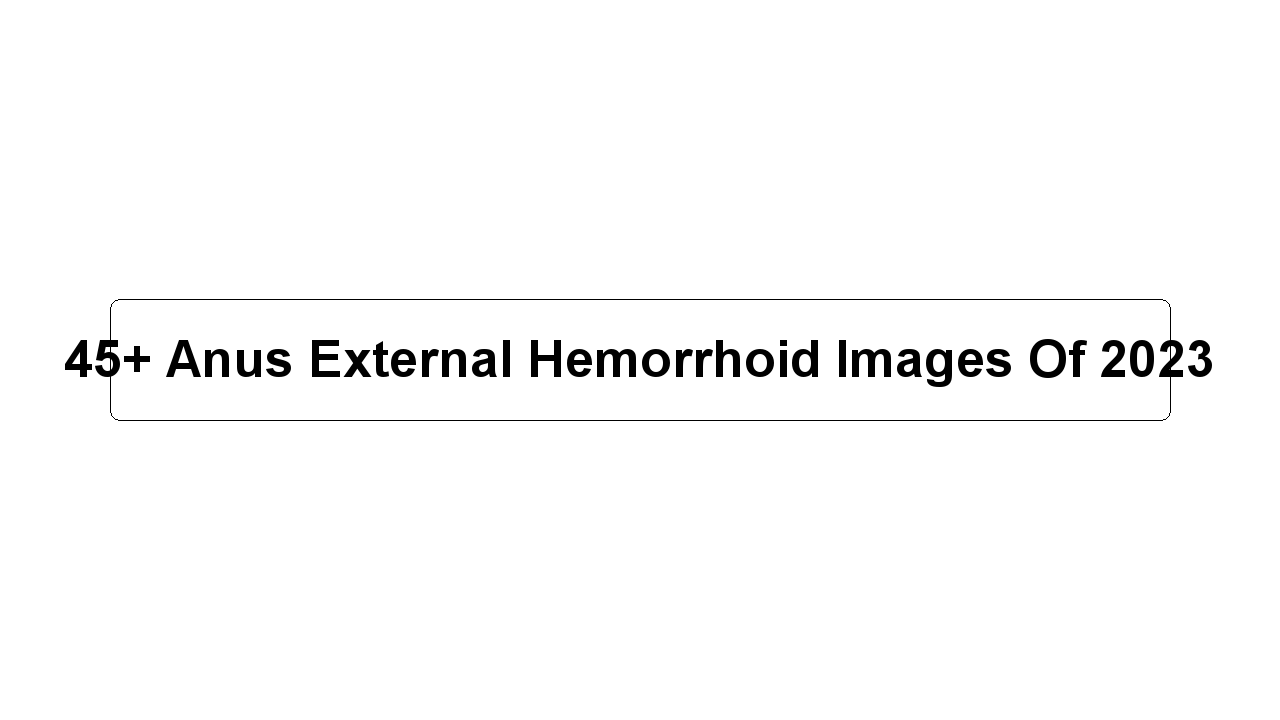 45+ Anus External Hemorrhoid Images Of 2023