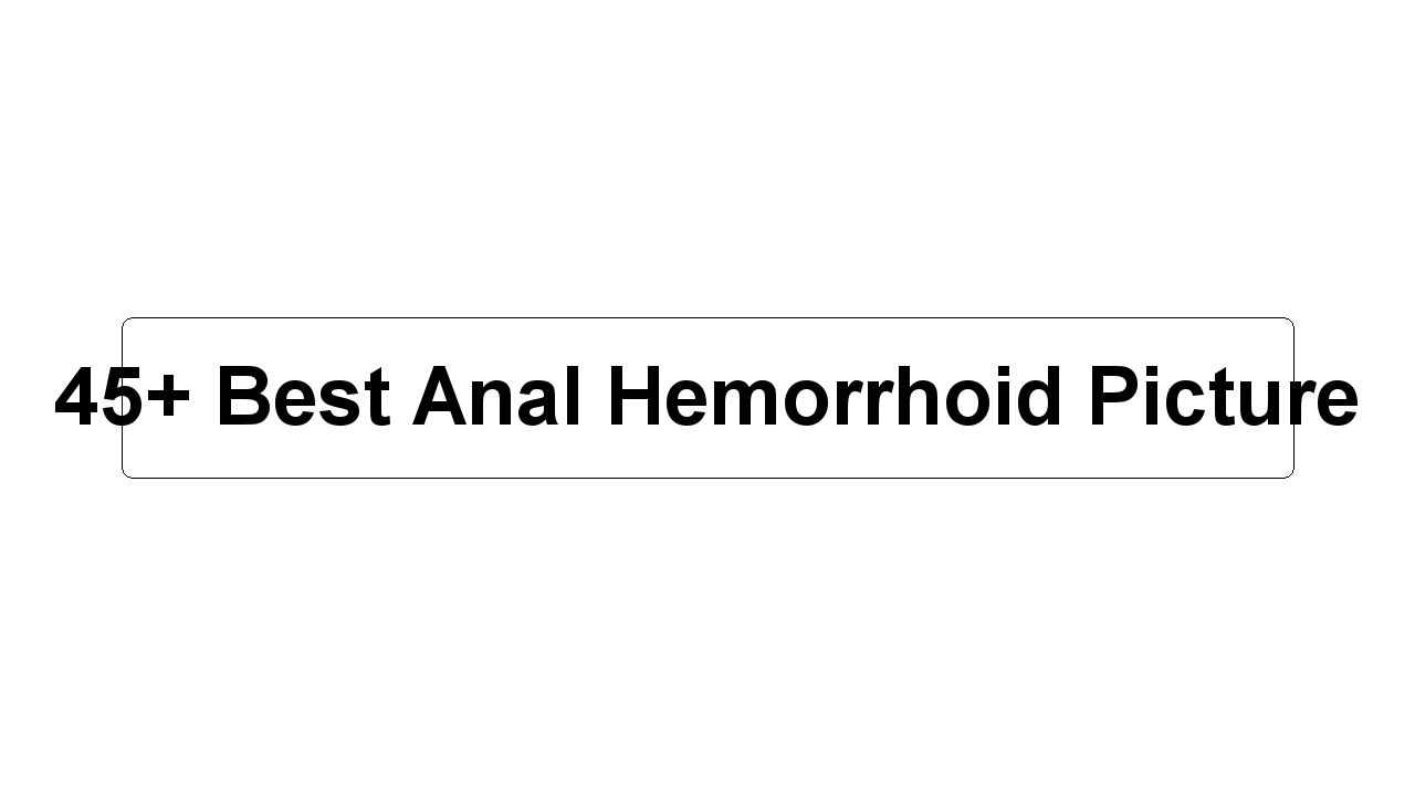 45+ Best Anal Hemorrhoid Picture