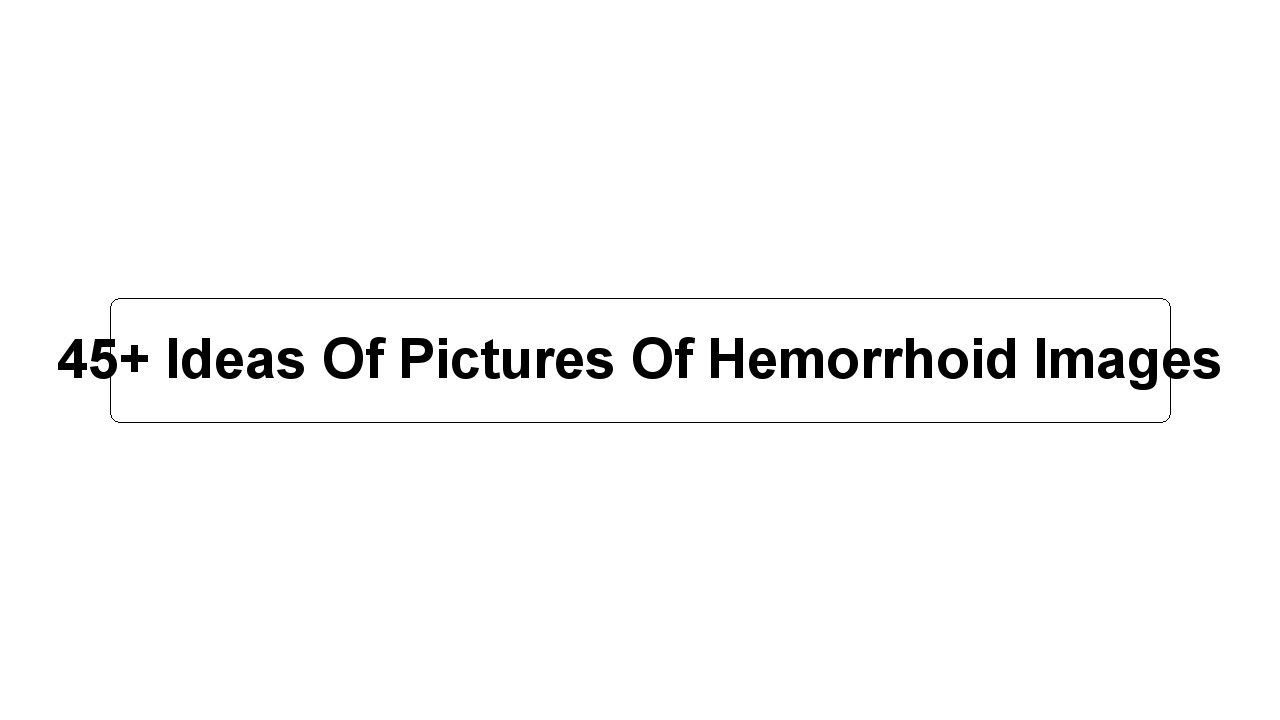 45+ Ideas Of Pictures Of Hemorrhoid Images