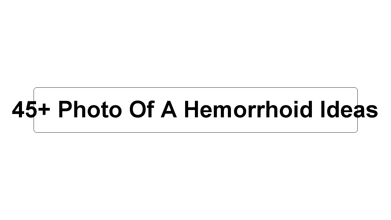 45+ Photo Of A Hemorrhoid Ideas