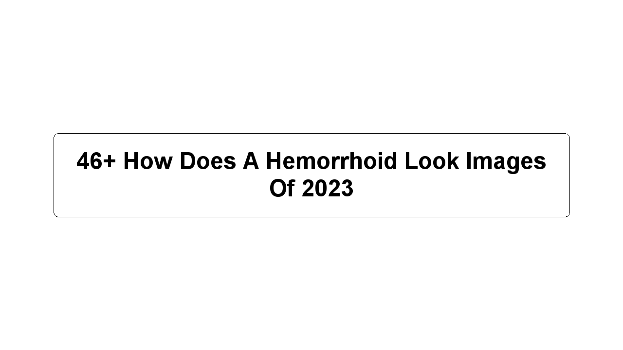 46+ How Does A Hemorrhoid Look Images Of 2023