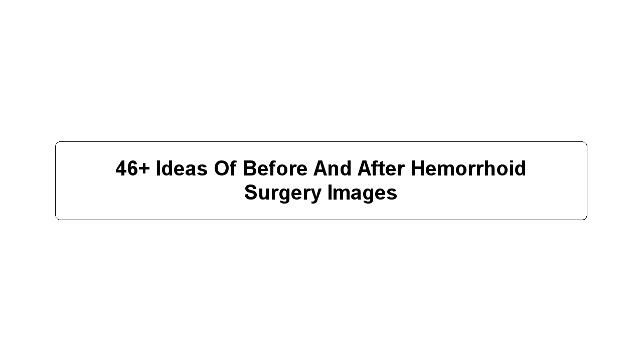 46+ Ideas Of Before And After Hemorrhoid Surgery Images