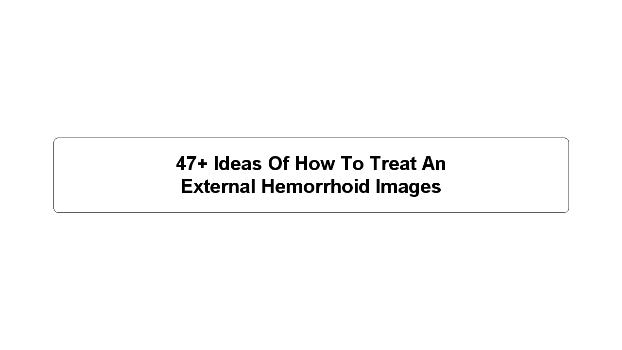 47+ Ideas Of How To Treat An External Hemorrhoid Images