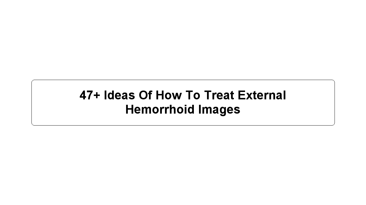 47+ Ideas Of How To Treat External Hemorrhoid Images