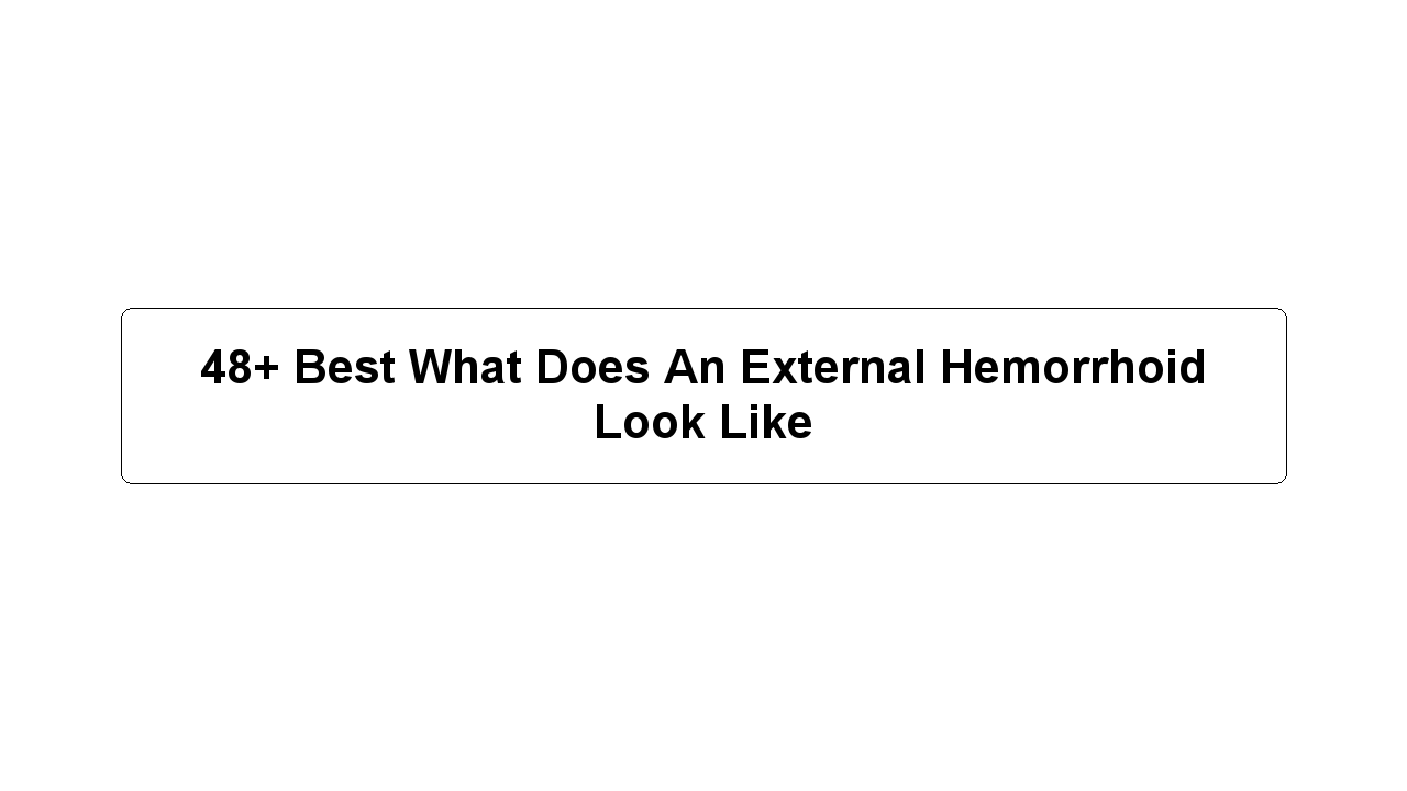 48+ Best What Does An External Hemorrhoid Look Like