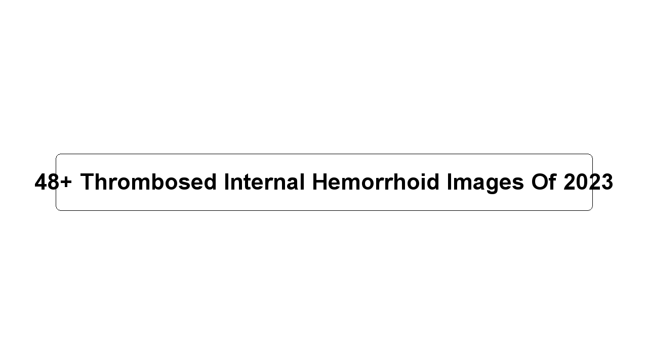 48+ Thrombosed Internal Hemorrhoid Images Of 2023