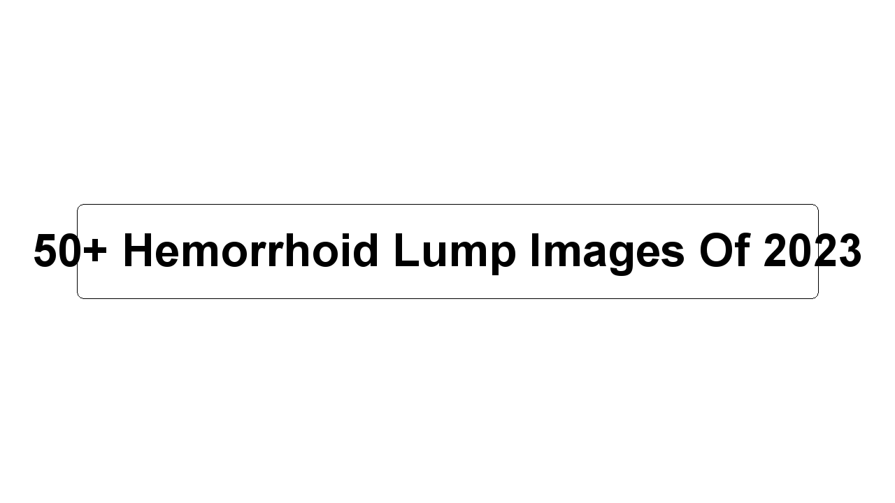 50+ Hemorrhoid Lump Images Of 2023