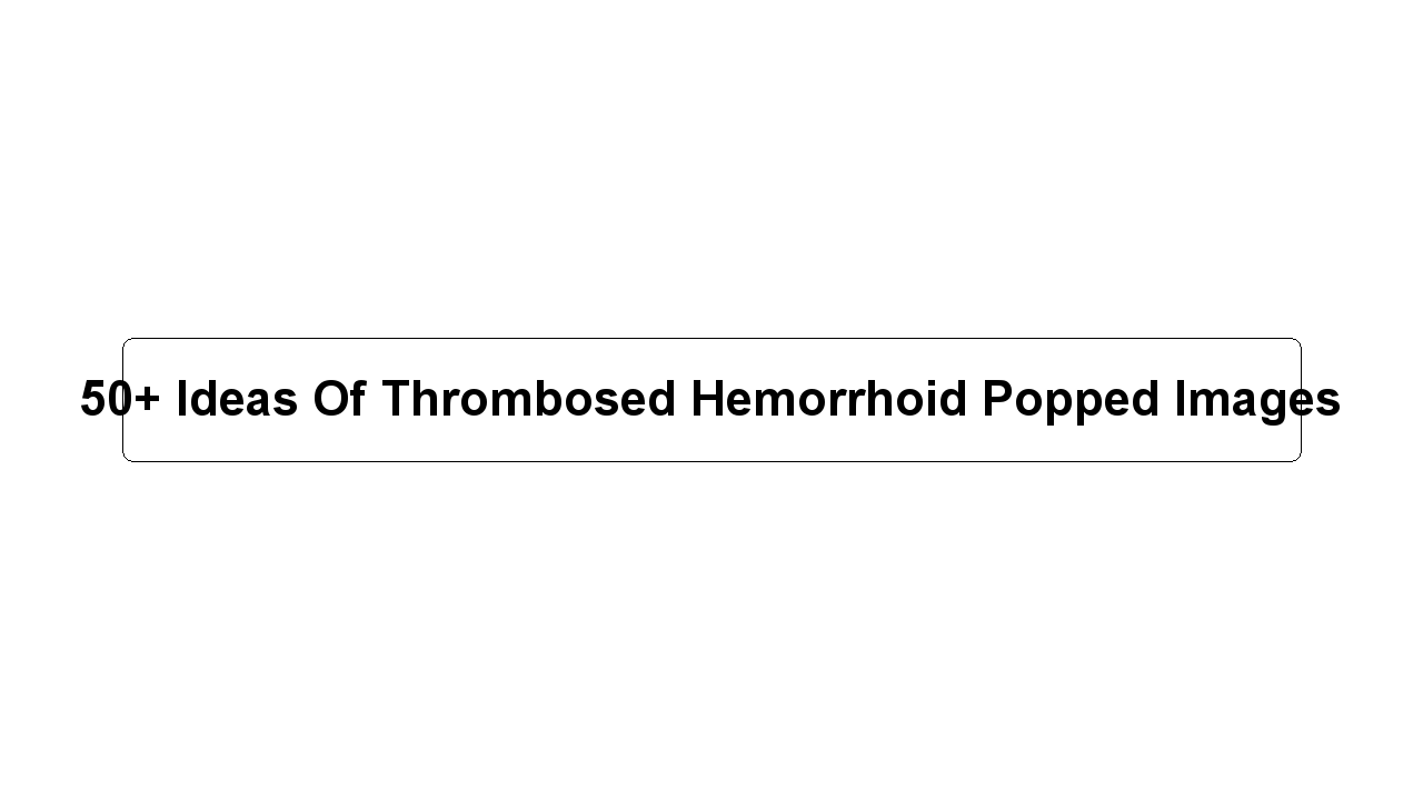 50+ Ideas Of Thrombosed Hemorrhoid Popped Images