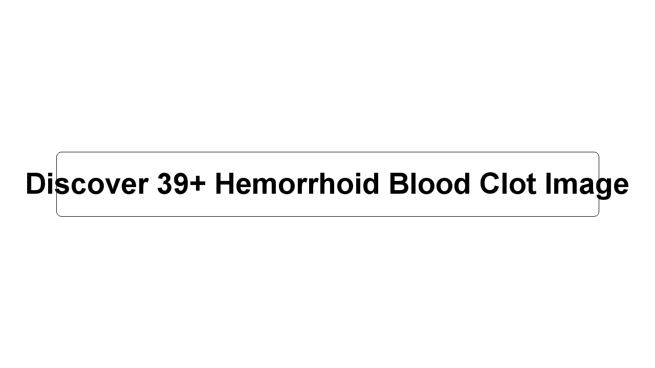 Discover 39+ Hemorrhoid Blood Clot Image