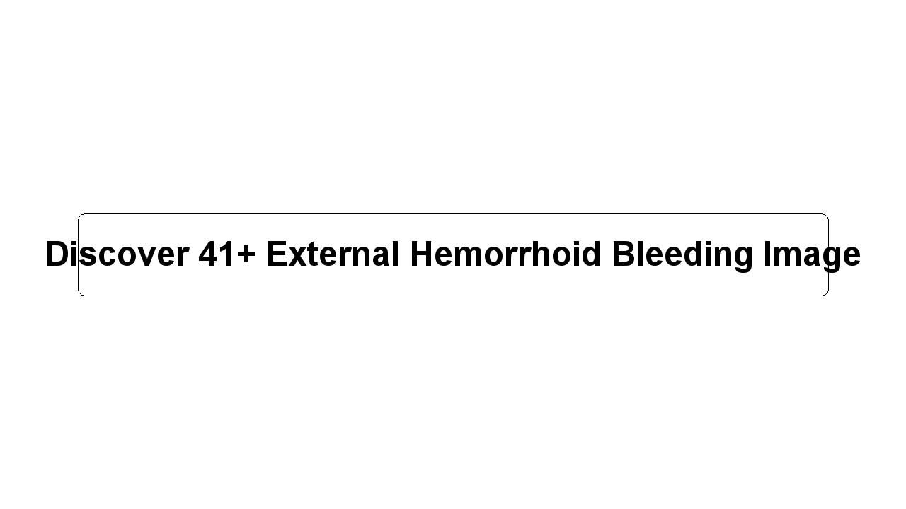 Discover 41+ External Hemorrhoid Bleeding Image