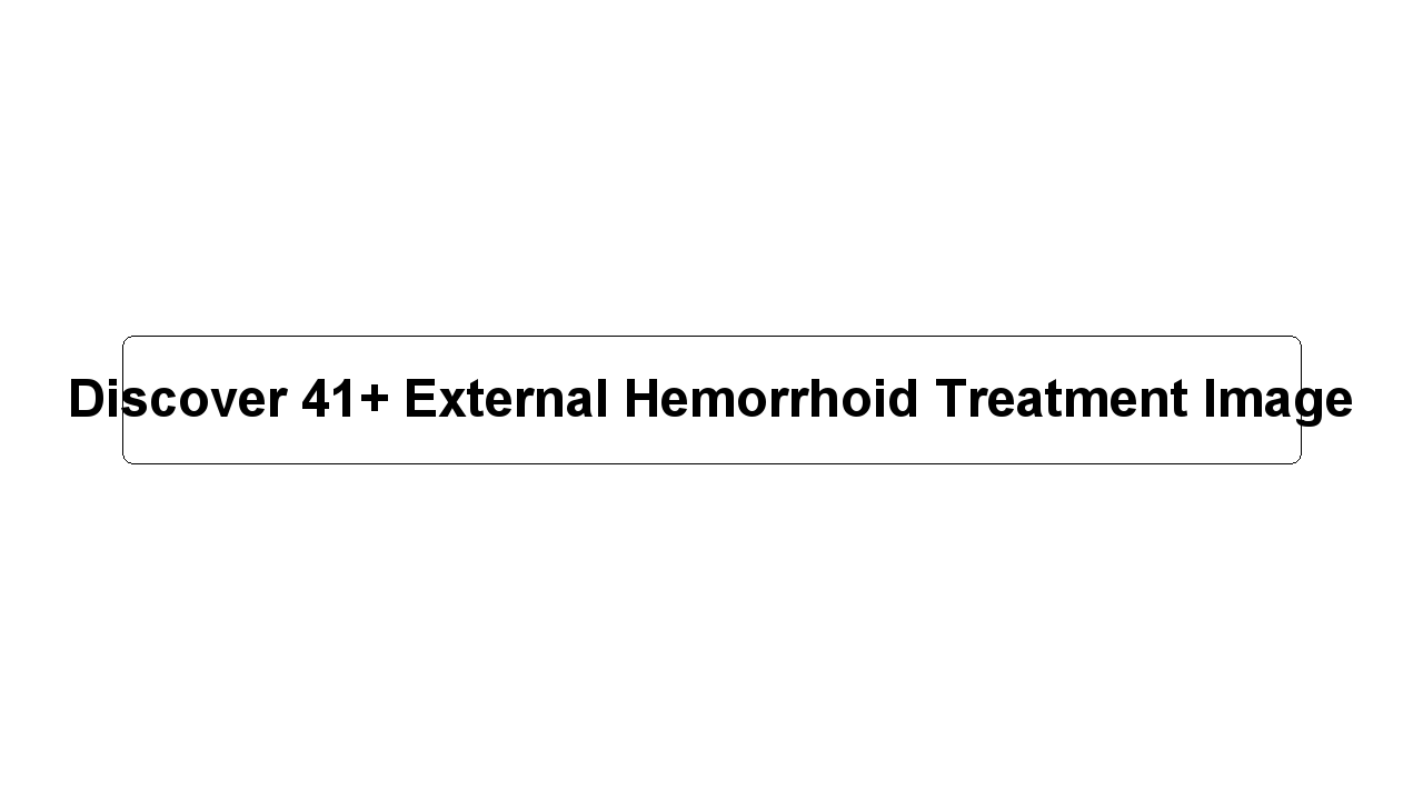 Discover 41+ External Hemorrhoid Treatment Image