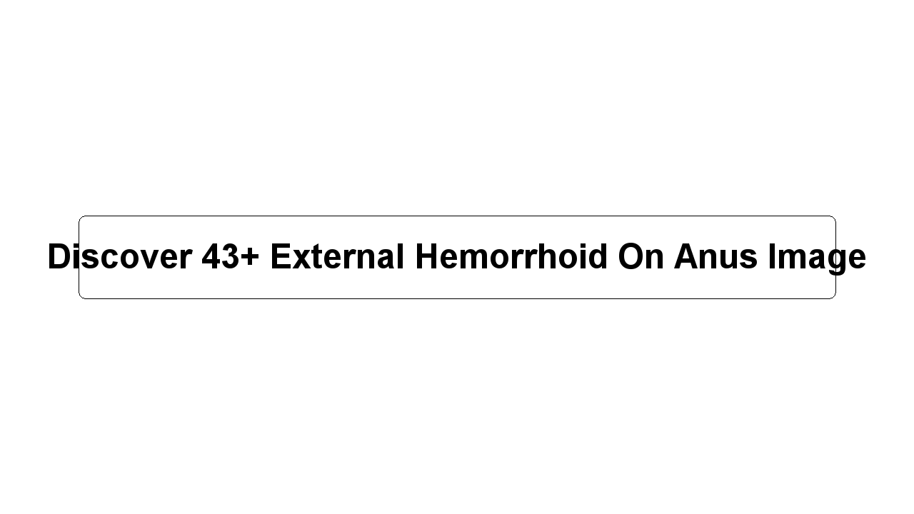 Discover 43+ External Hemorrhoid On Anus Image