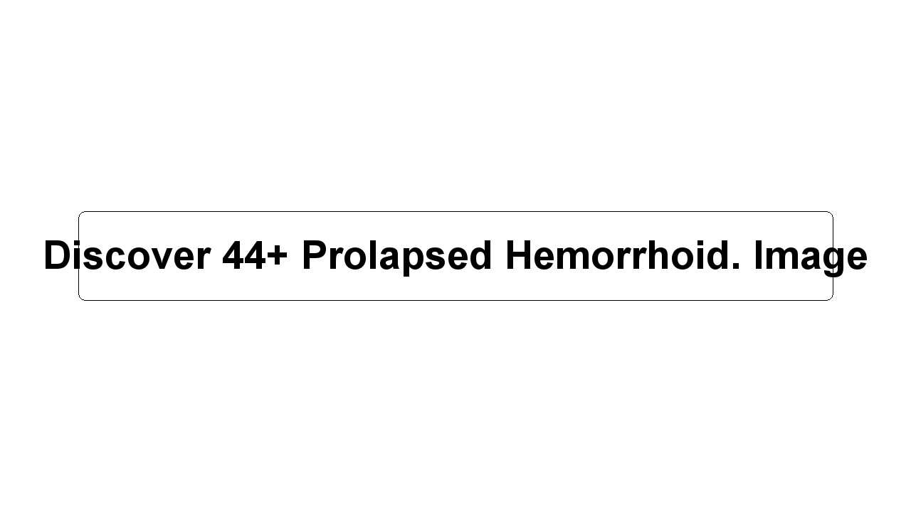 Discover 44+ Prolapsed Hemorrhoid. Image