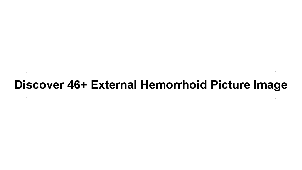 Discover 46+ External Hemorrhoid Picture Image