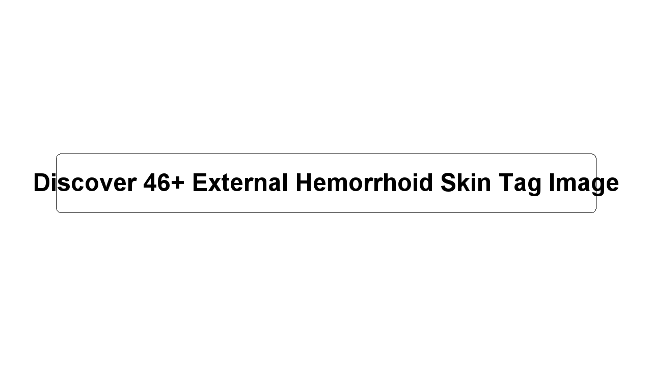 Discover 46+ External Hemorrhoid Skin Tag Image