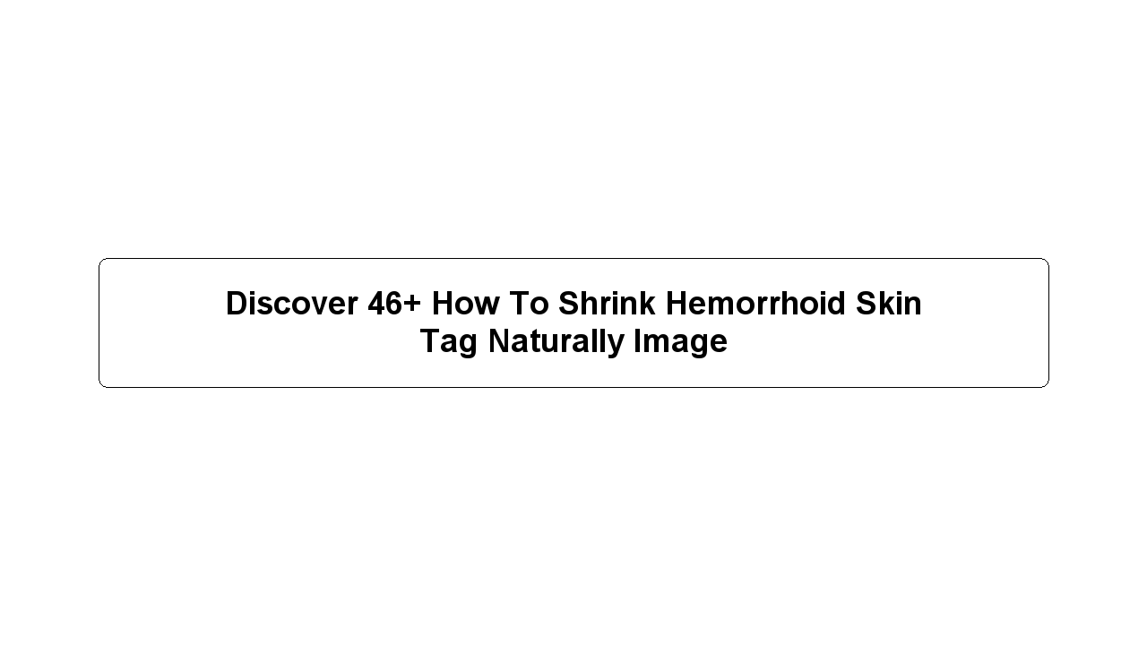 Discover 46+ How To Shrink Hemorrhoid Skin Tag Naturally Image