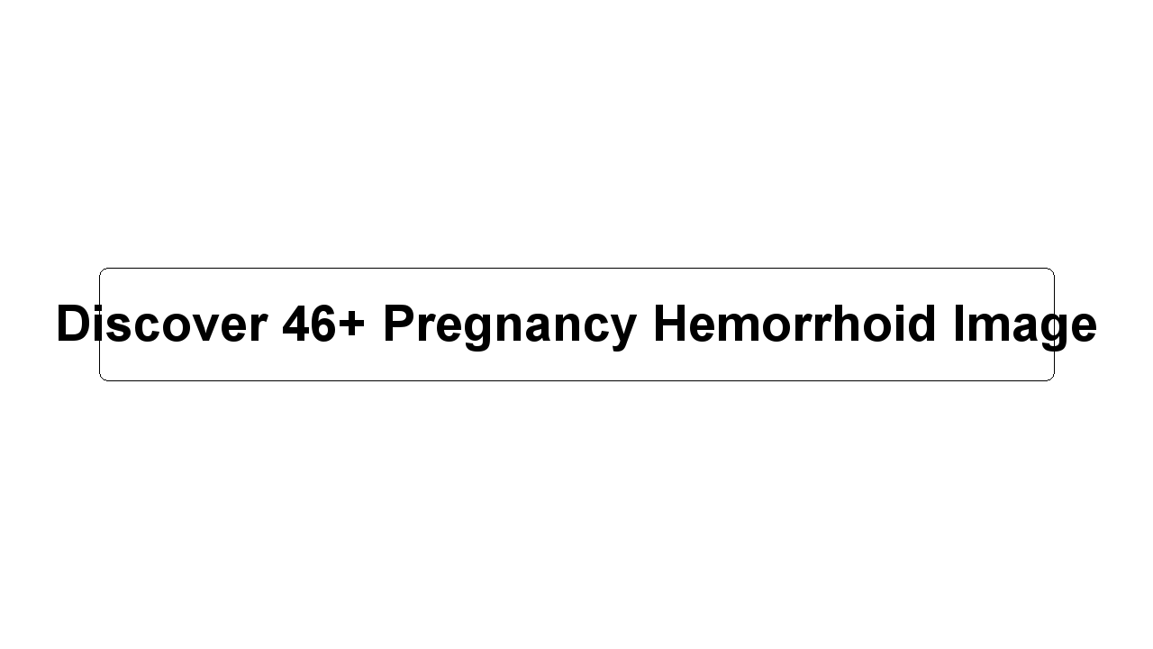 Discover 46+ Pregnancy Hemorrhoid Image