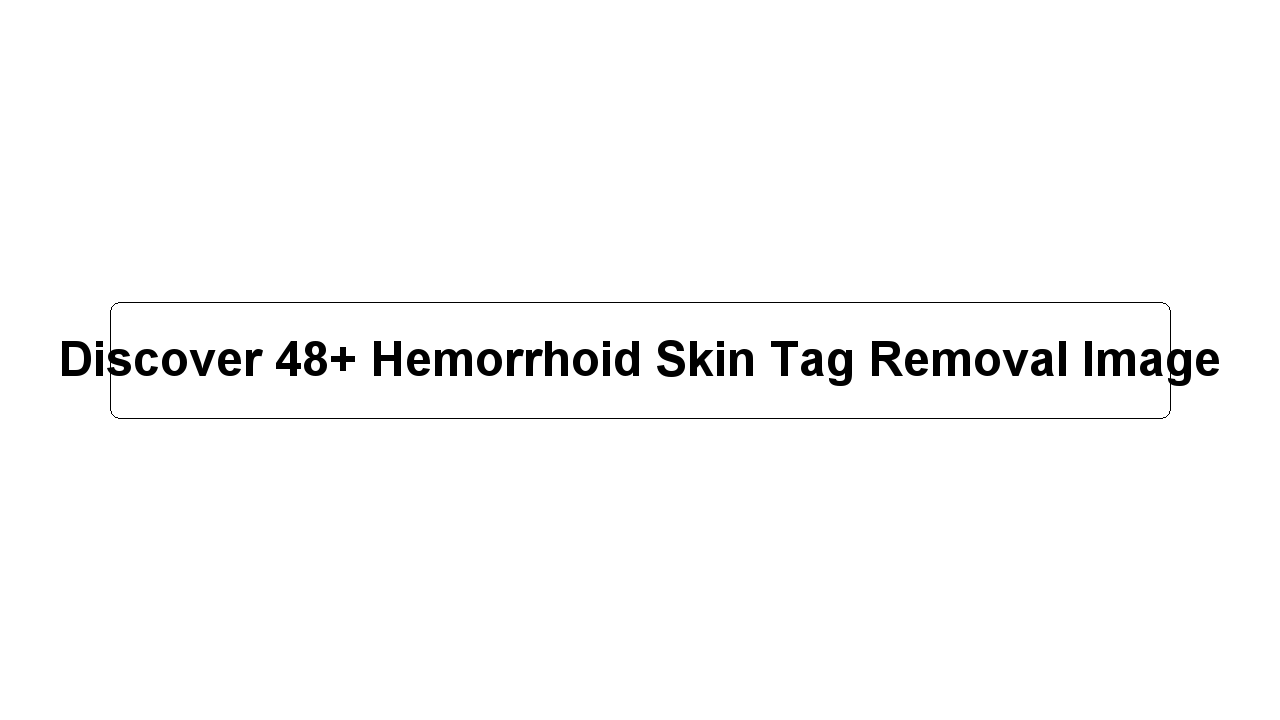 Discover 48+ Hemorrhoid Skin Tag Removal Image