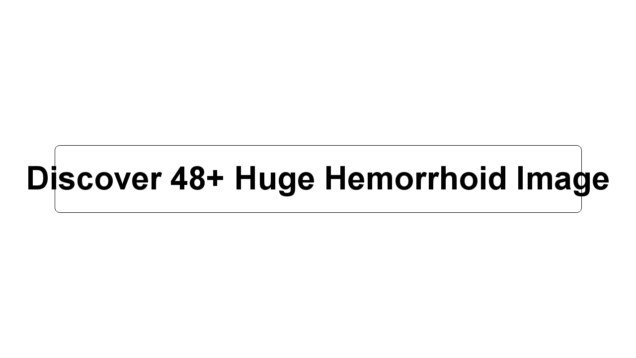 Discover 48+ Huge Hemorrhoid Image