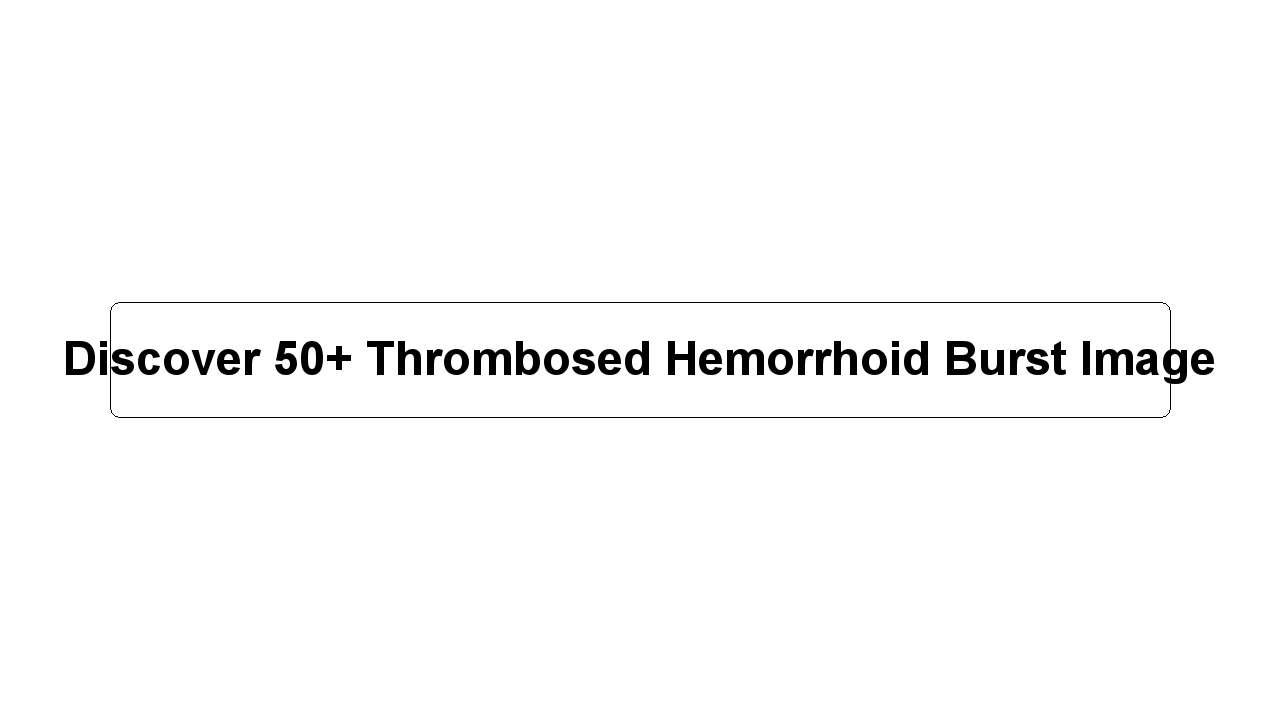 Discover 50+ Thrombosed Hemorrhoid Burst Image