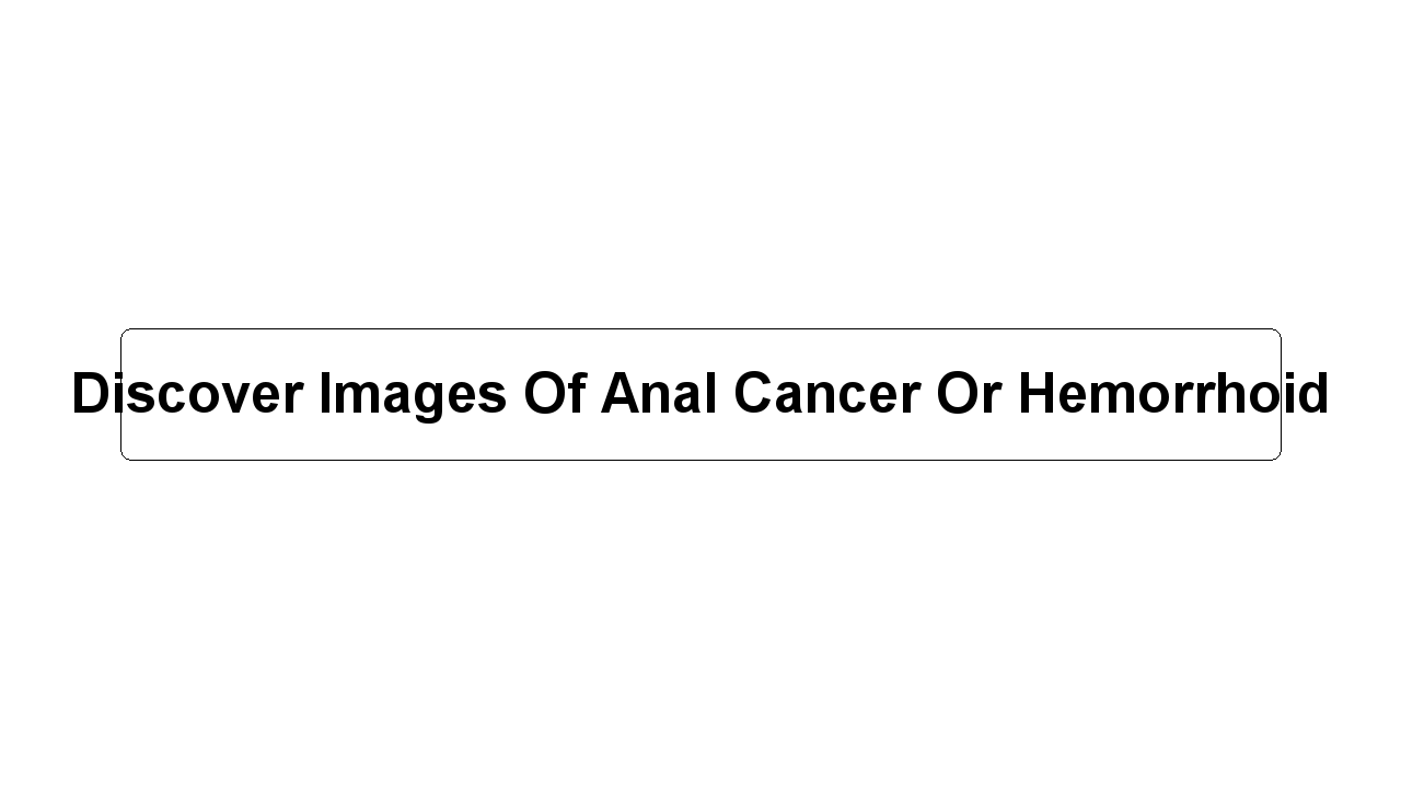 Discover Images Of Anal Cancer Or Hemorrhoid