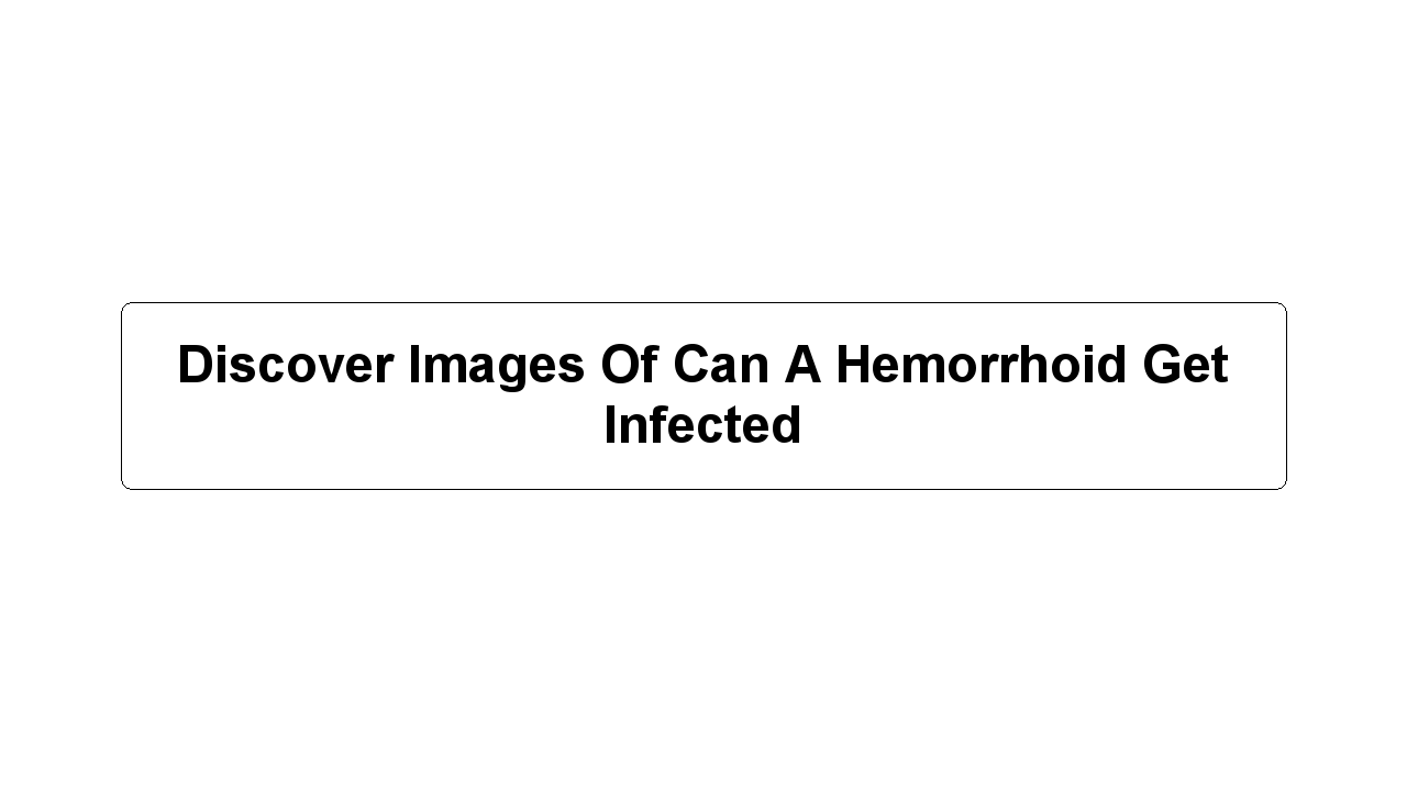 Discover Images Of Can A Hemorrhoid Get Infected