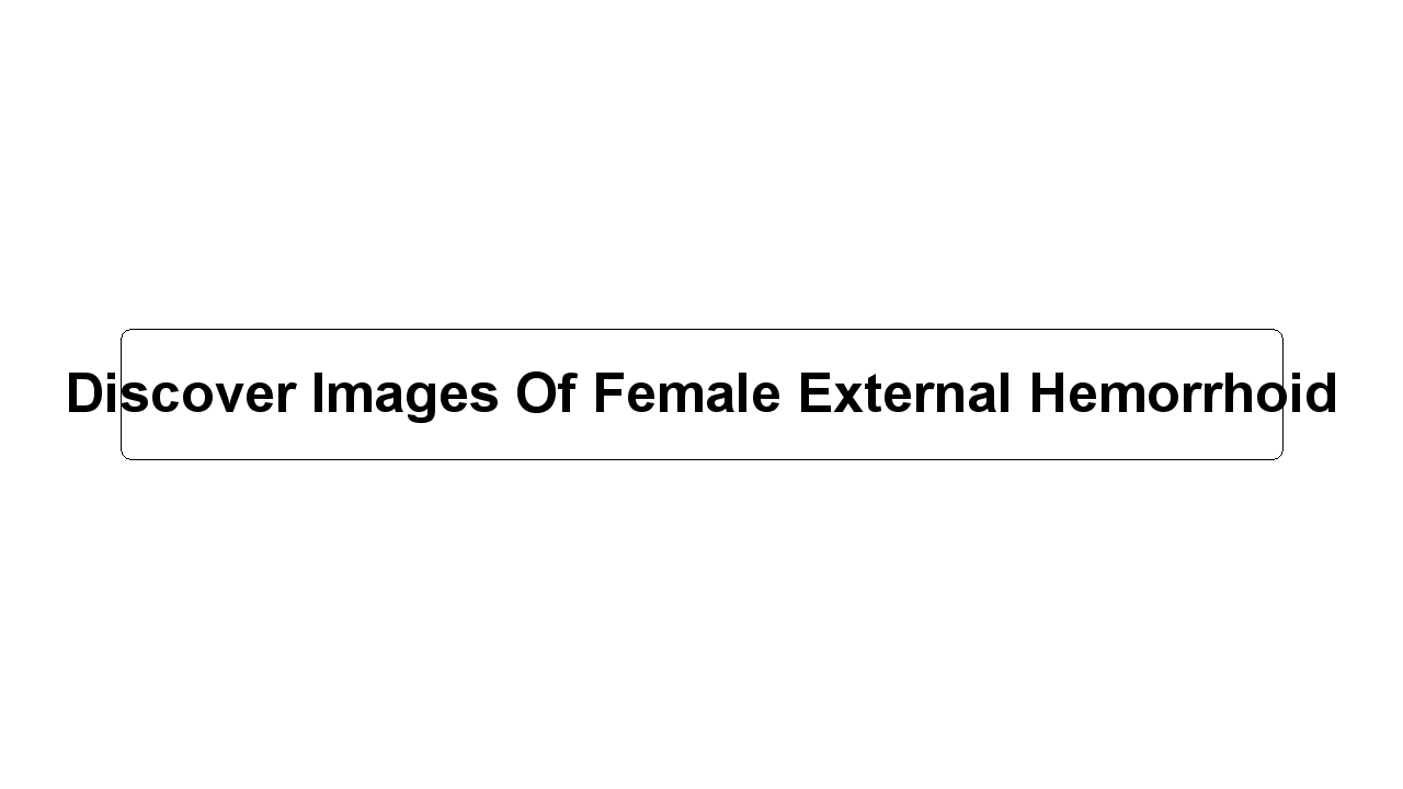 Discover Images Of Female External Hemorrhoid