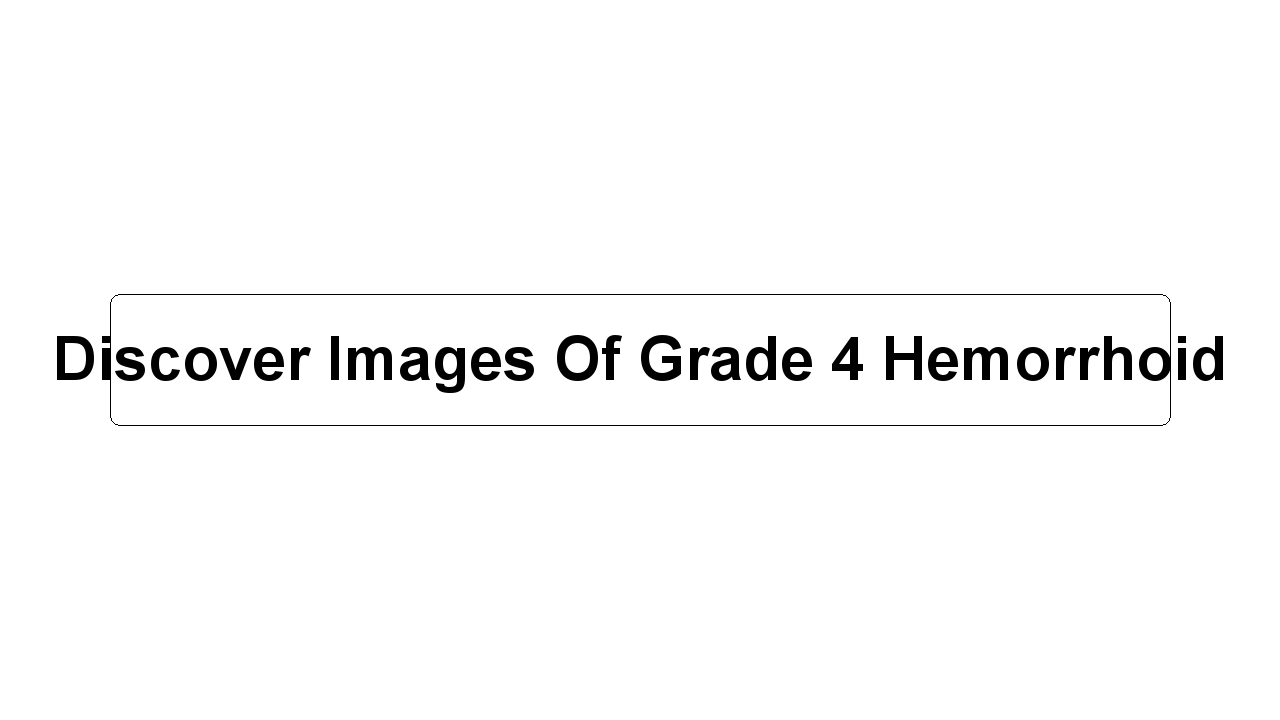 Discover Images Of Grade 4 Hemorrhoid