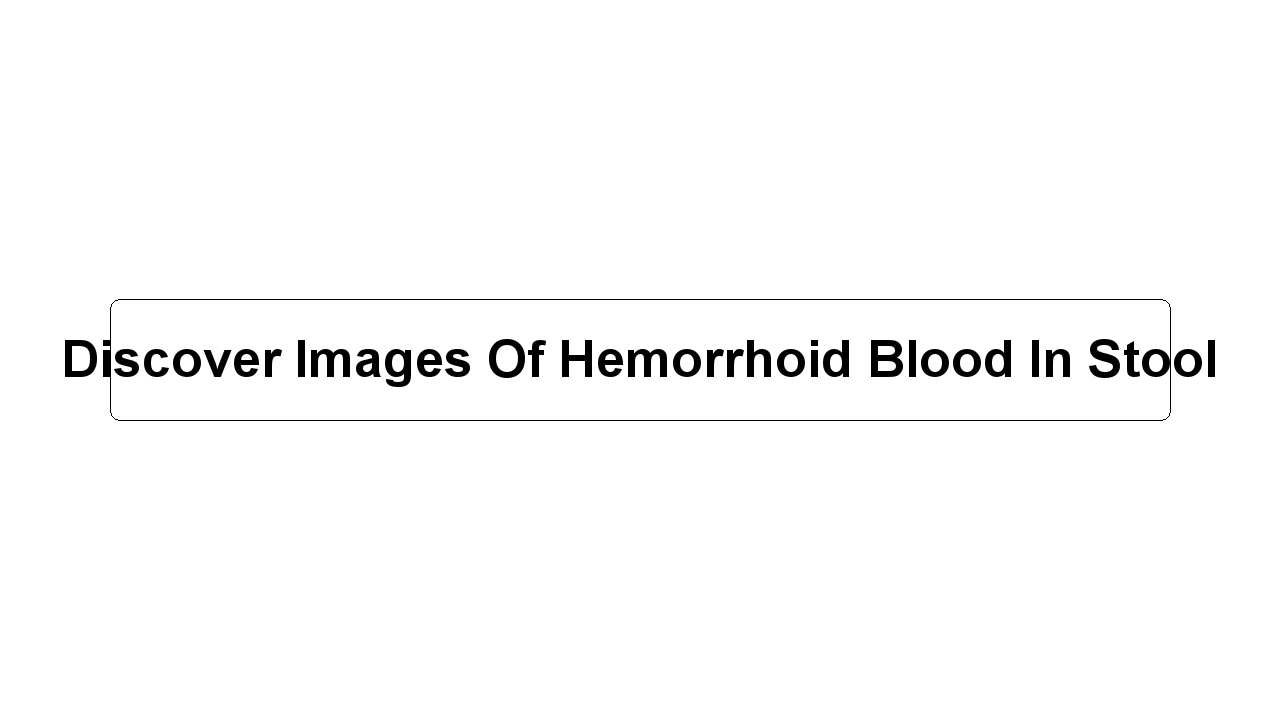 Discover Images Of Hemorrhoid Blood In Stool