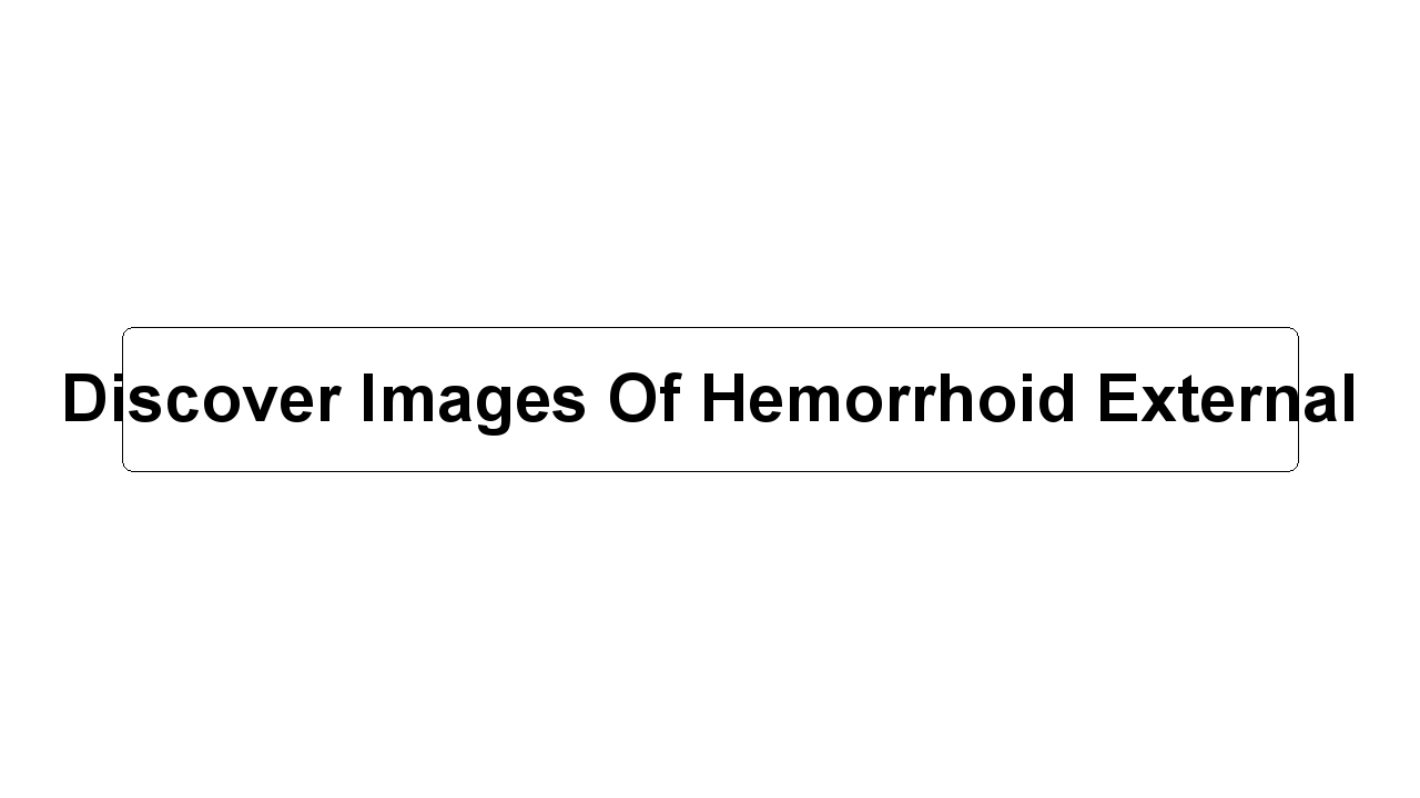 Discover Images Of Hemorrhoid External