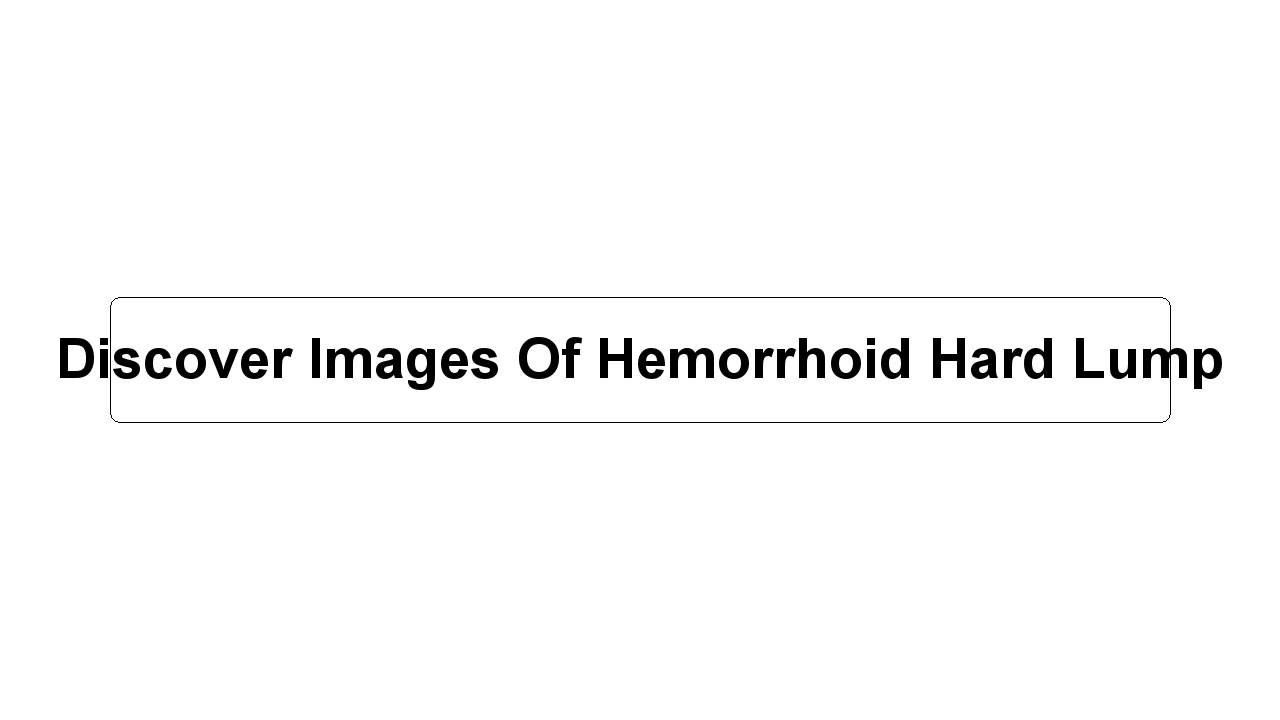 Discover Images Of Hemorrhoid Hard Lump