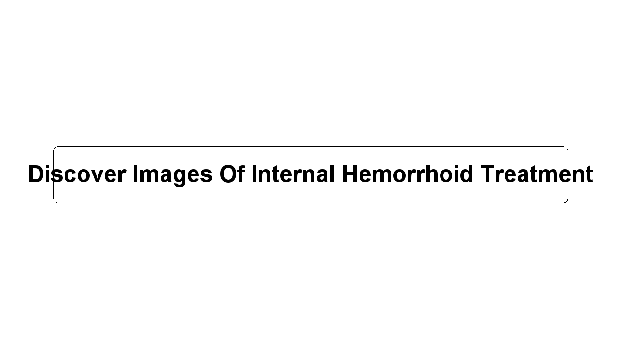 Discover Images Of Internal Hemorrhoid Treatment