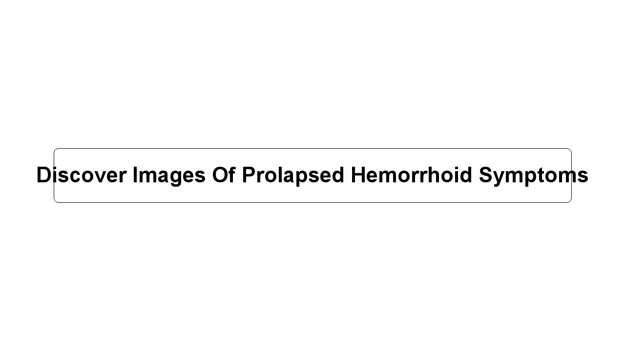 Discover Images Of Prolapsed Hemorrhoid Symptoms