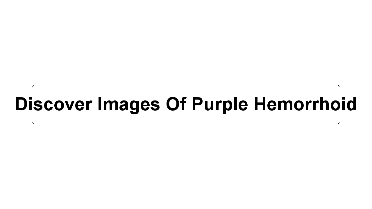 Discover Images Of Purple Hemorrhoid