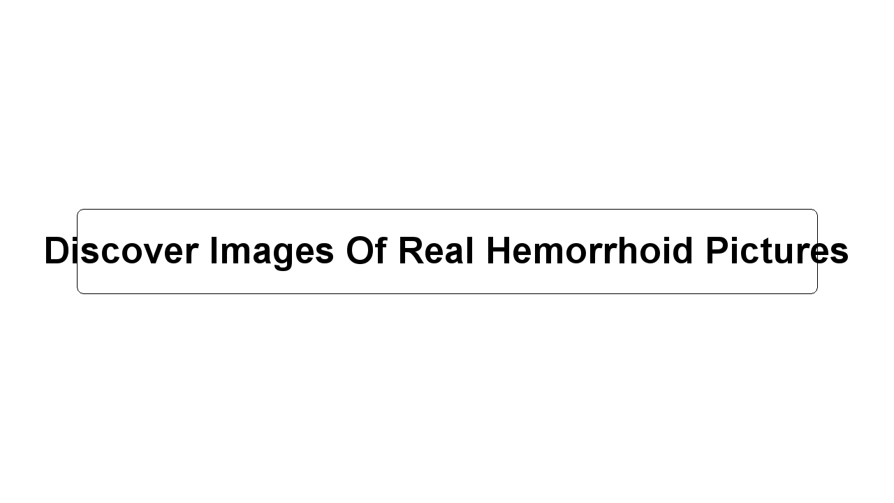 Discover Images Of Real Hemorrhoid Pictures