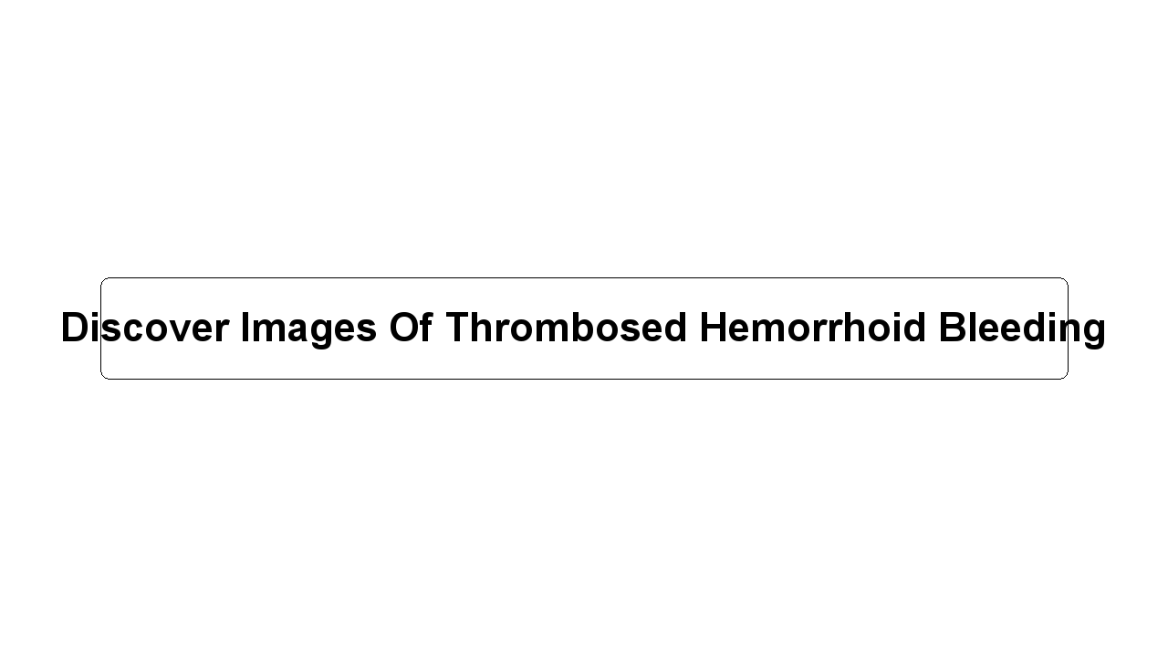 Discover Images Of Thrombosed Hemorrhoid Bleeding