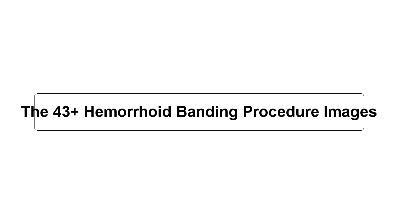 The 43+ Hemorrhoid Banding Procedure Images