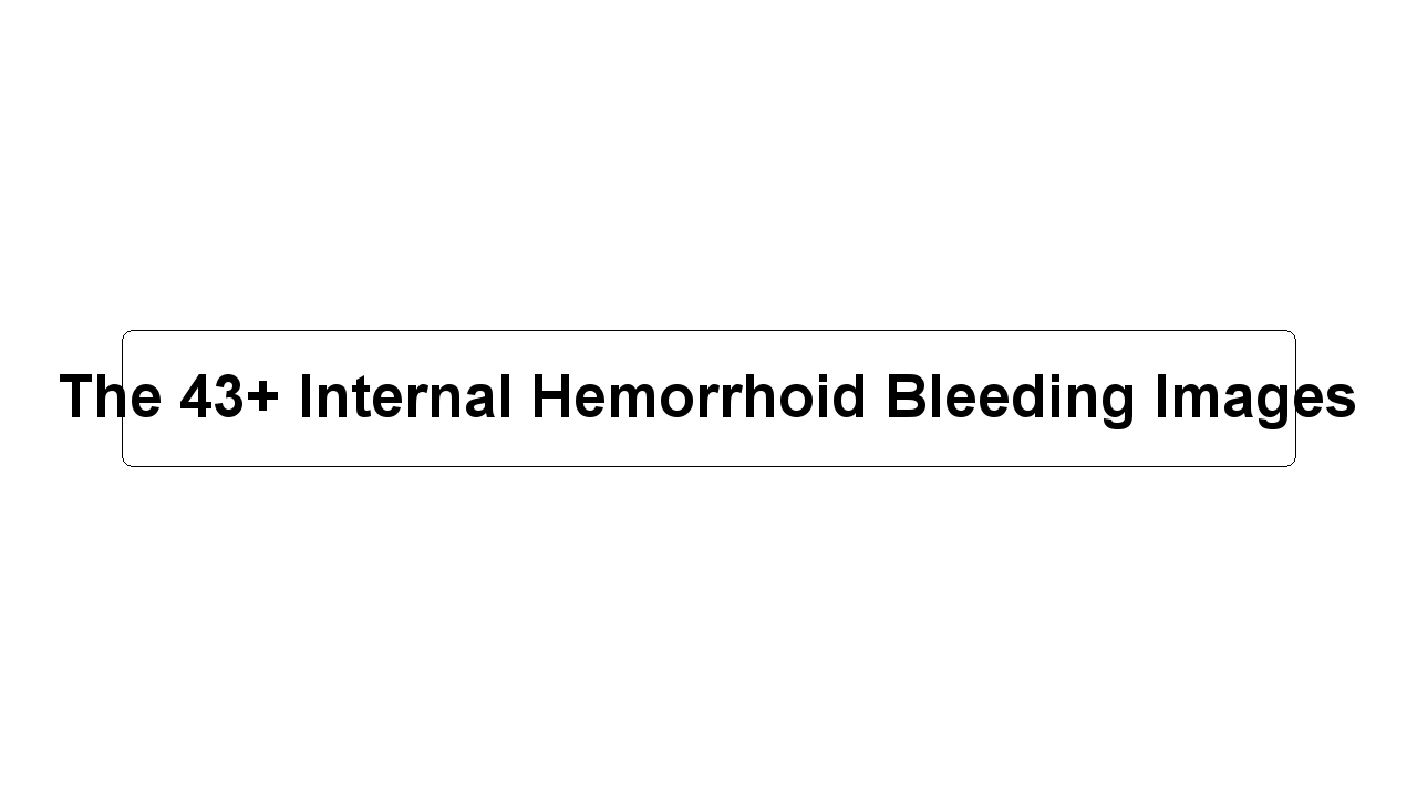 The 43+ Internal Hemorrhoid Bleeding Images