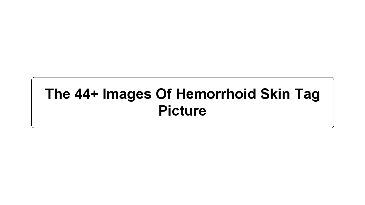 The 44+ Images Of Hemorrhoid Skin Tag Picture