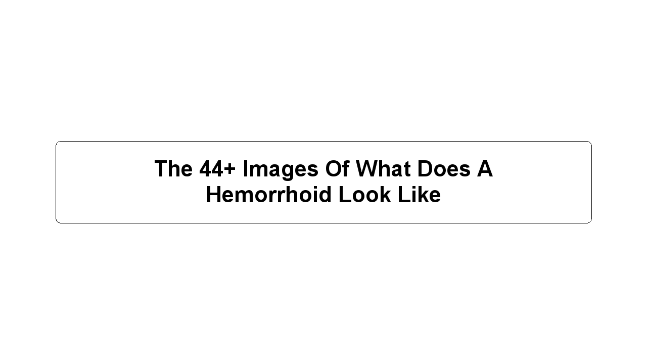 The 44+ Images Of What Does A Hemorrhoid Look Like