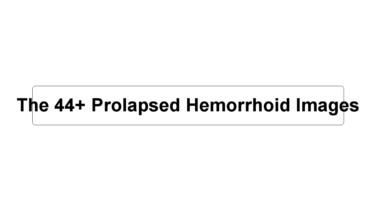 The 44+ Prolapsed Hemorrhoid Images