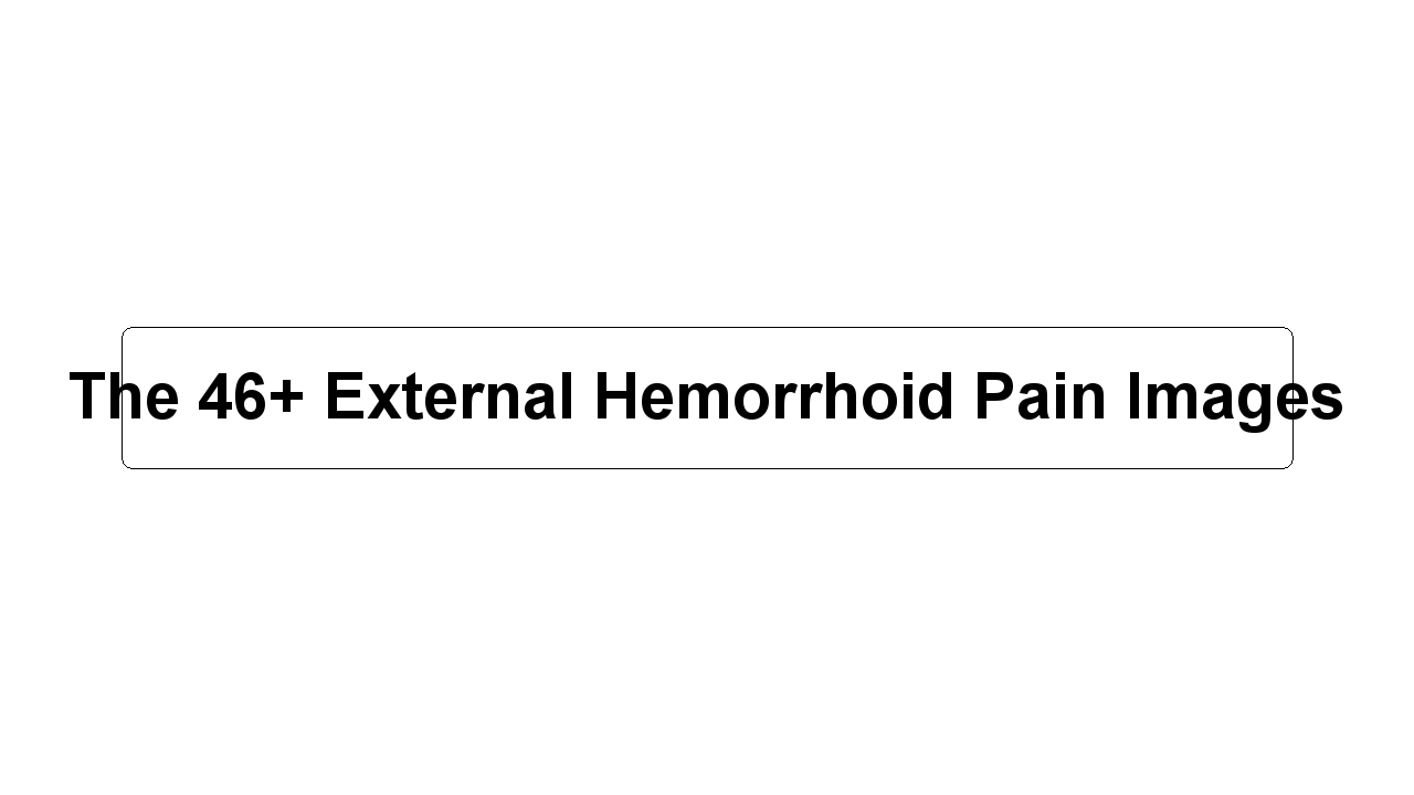 The 46+ External Hemorrhoid Pain Images