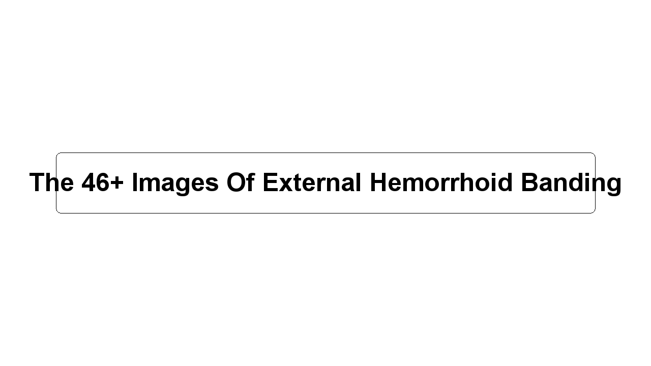 The 46+ Images Of External Hemorrhoid Banding