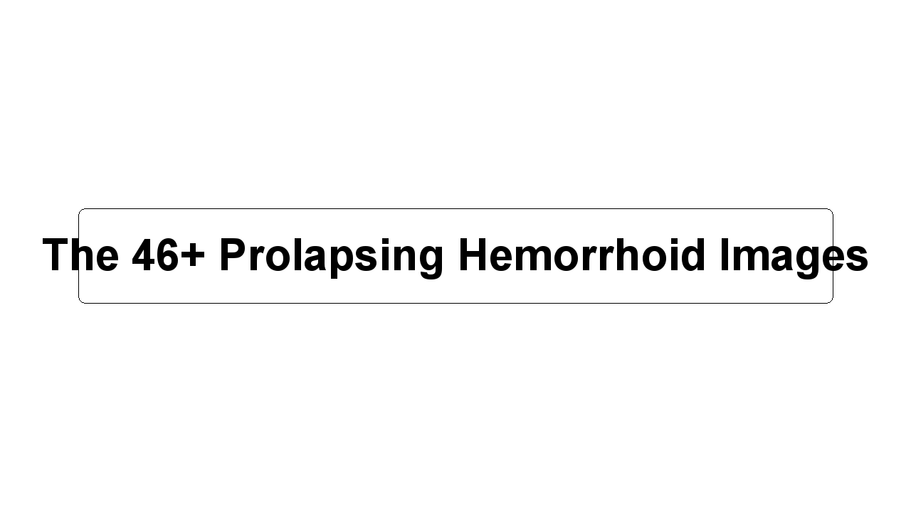 The 46+ Prolapsing Hemorrhoid Images