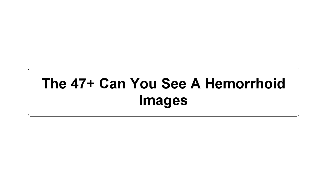 The 47+ Can You See A Hemorrhoid Images