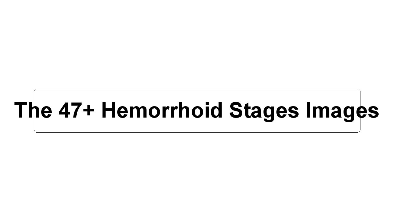 The 47+ Hemorrhoid Stages Images